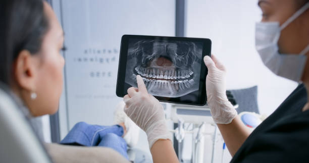 Licensed Tooth Extraction service in Isle of Palms, SC - Smile Center Dentistry